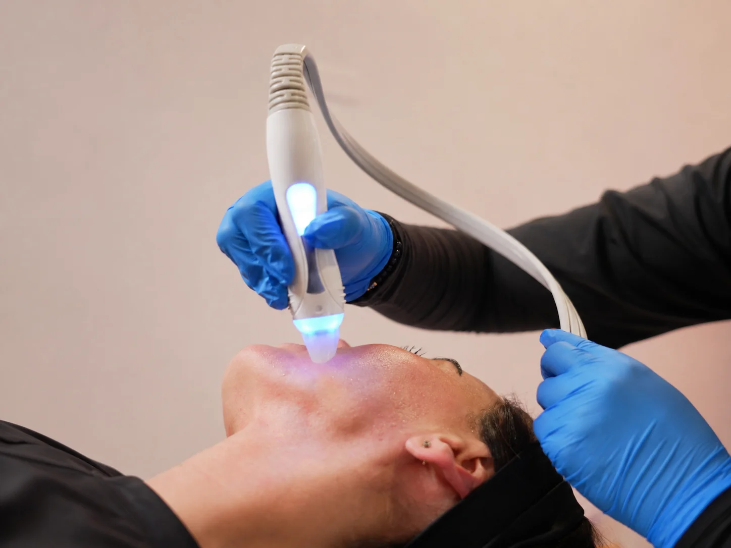 Inpure limpieza facial profunda en Revib