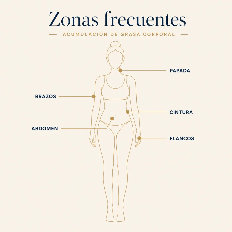 Zonas frecuentes de grasa localizada: abdomen, cintura, flancos, brazos y papada
