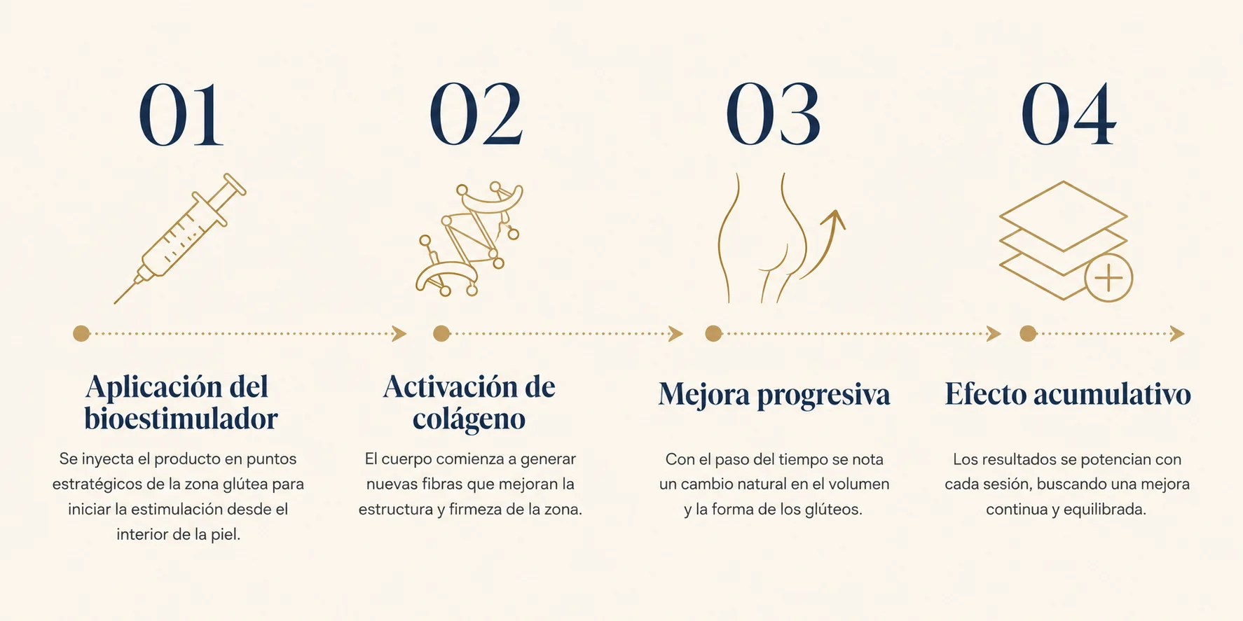 Infografía: pasos del proceso de bioestimulación de colágeno con sculptra en glúteos