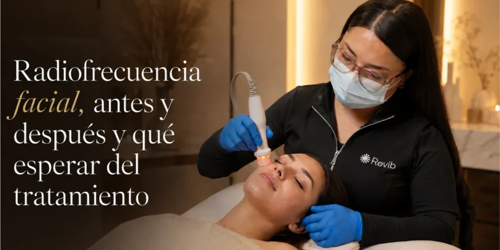 Radiofrecuencia facial para firmeza y colágeno