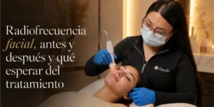 Radiofrecuencia facial para firmeza y colágeno