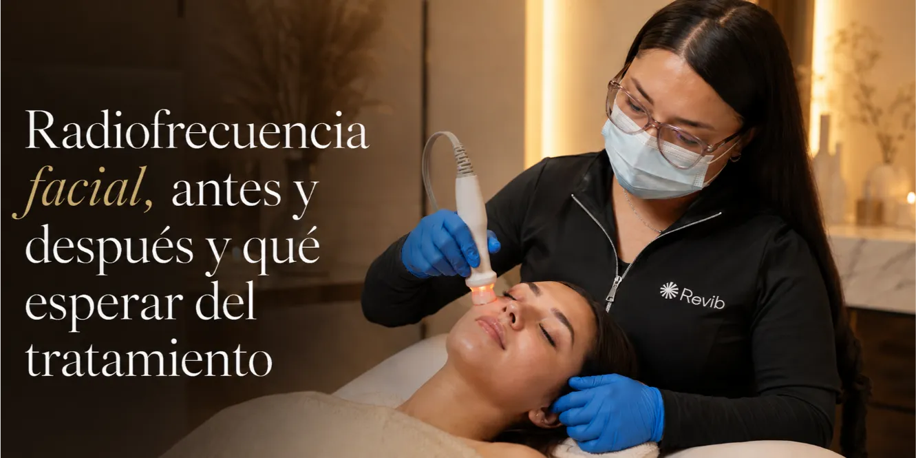 Radiofrecuencia facial, antes y después y qué esperar del tratamiento