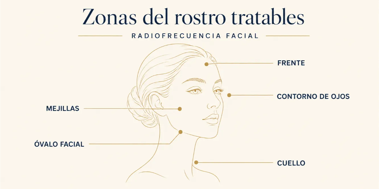 Zonas del rostro y el cuello donde se puede aplicar el tratamiento