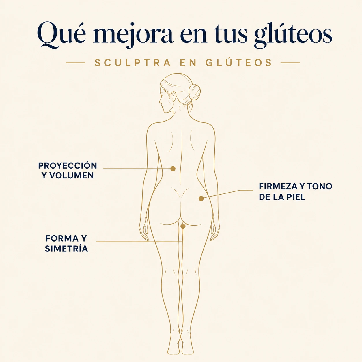 Infografía: zonas que mejora sculptra en glúteos — proyección, firmeza y forma